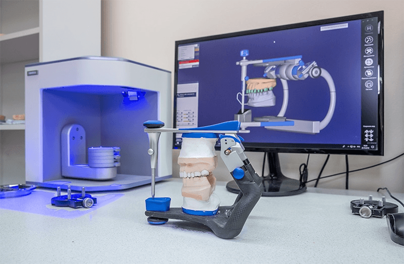 Tecnología digital CAD CAM en clínica dental